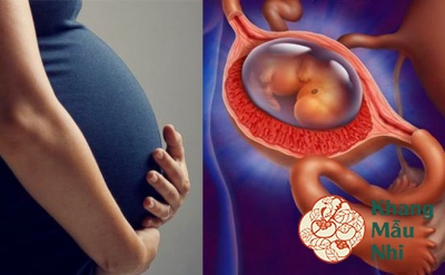 Ra máu khi mang thai tháng cuối báo hiệu điều gì?