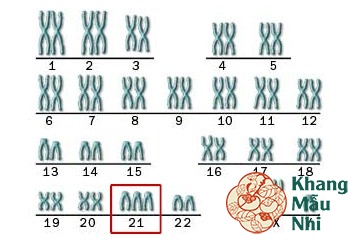 Sảy thai liên tiếp do bất thường nhiễm sắc thể phải làm gì?