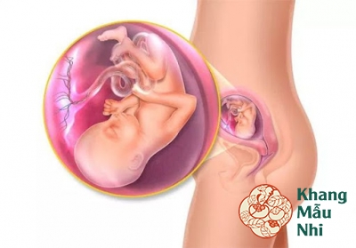 Đau bụng khi mang thai tháng thứ 5: Mẹ bầu đừng chủ quan!