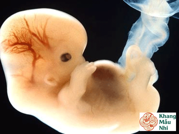 Phải làm gì khi thai nhi không có tim thai?