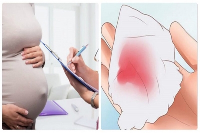 Giải đáp thắc mắc: Dọa sảy thai có nguy hiểm không?